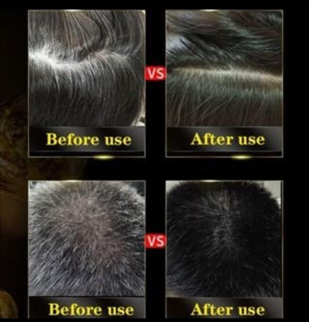 Unisex Instant Black Herbal Hair Dye Shampoo for Grey Hair Coverage Shampoo 3 in 1(800 gm) Pack of 5