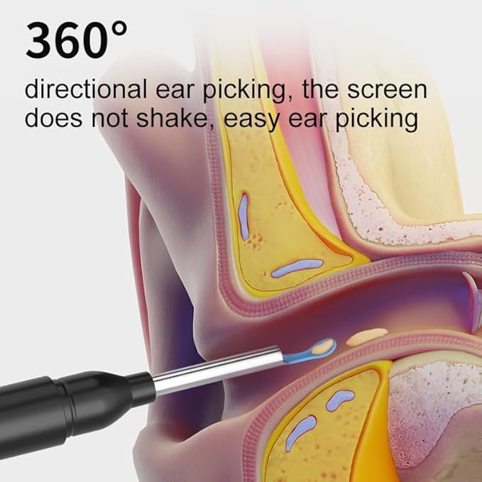 Smart Visual Earwax Cleaner