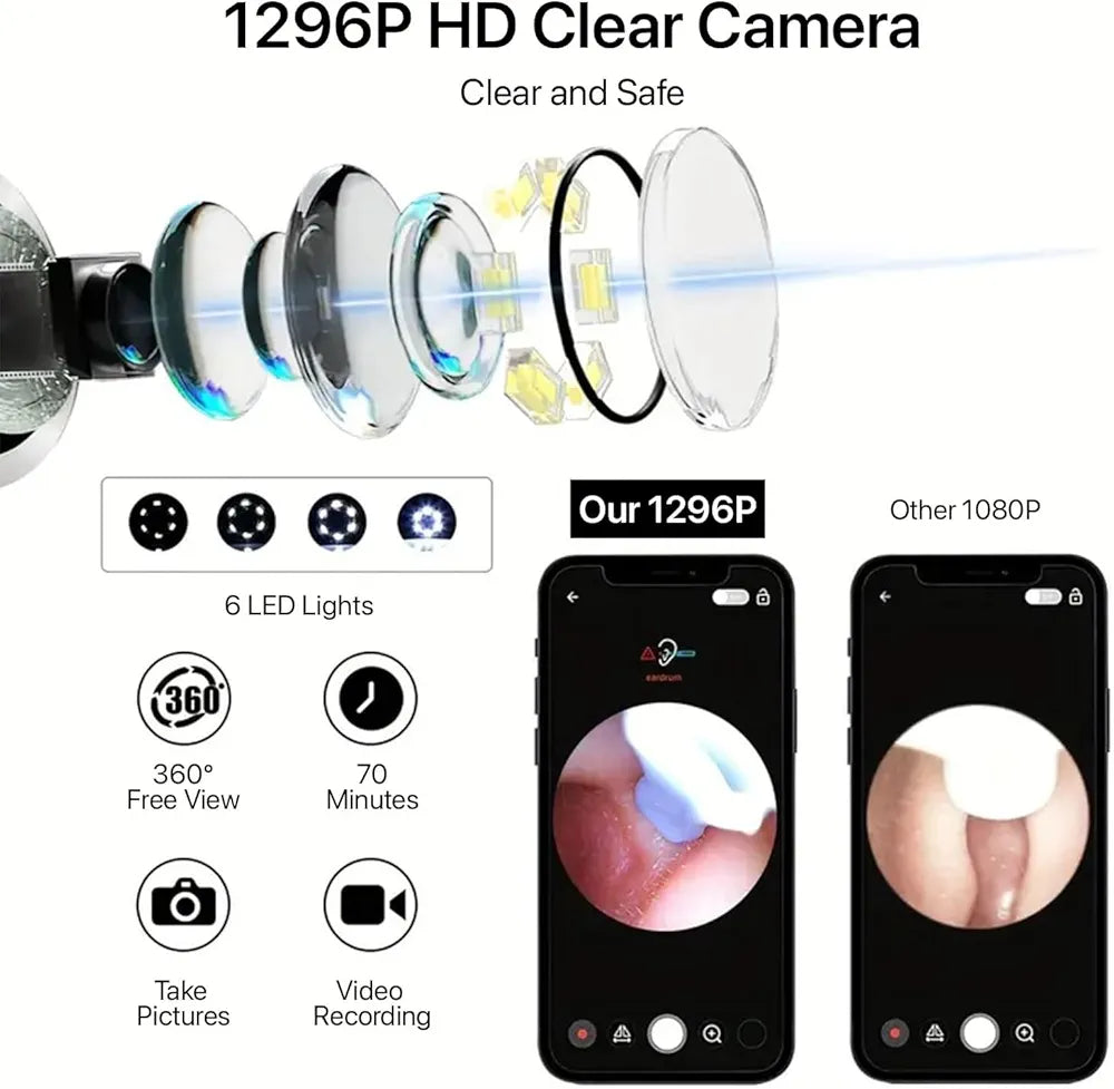 Smart Visual Earwax Cleaner