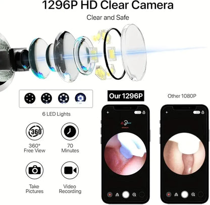 Smart Visual Earwax Cleaner