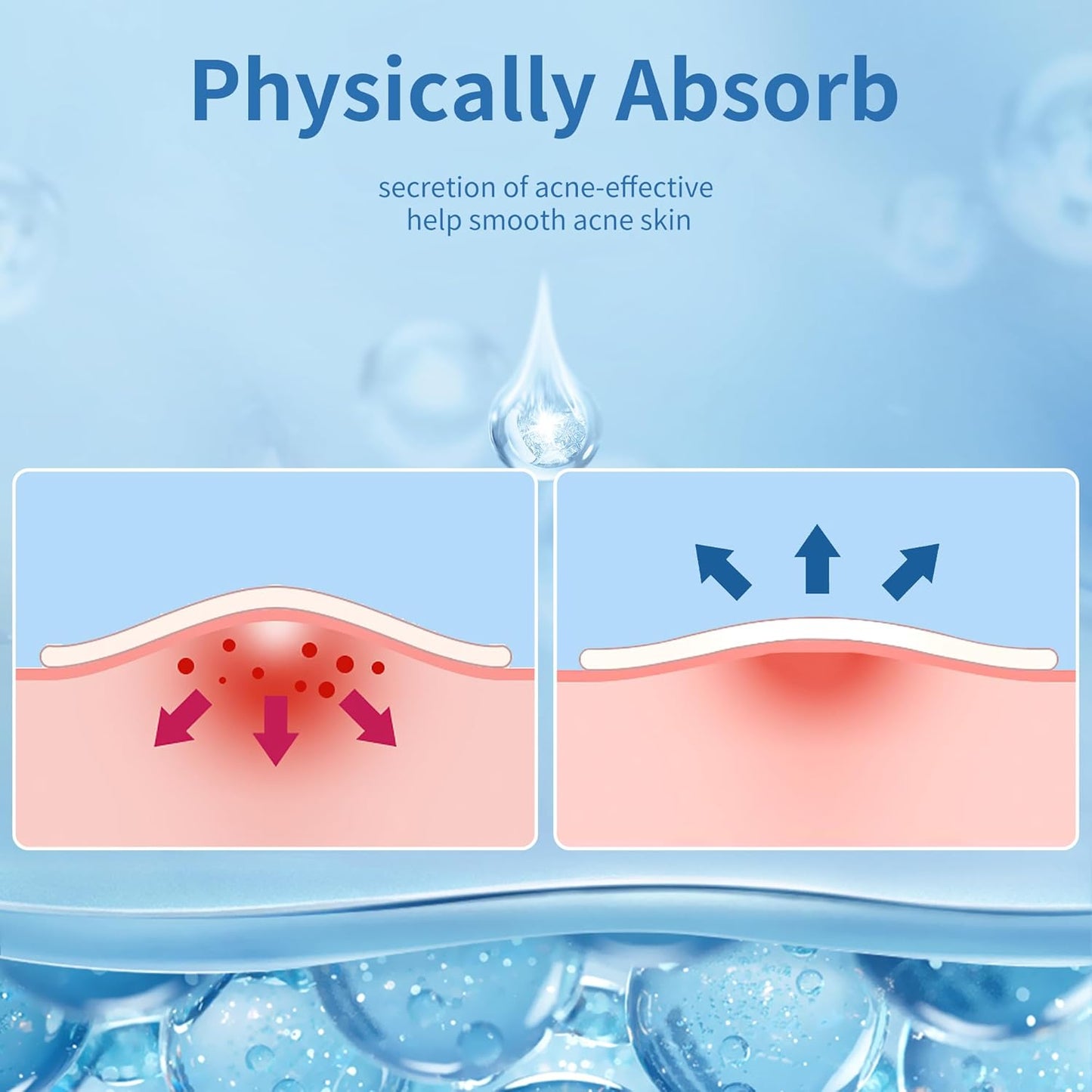 Acne™ Pimple Patch 72 Pcs