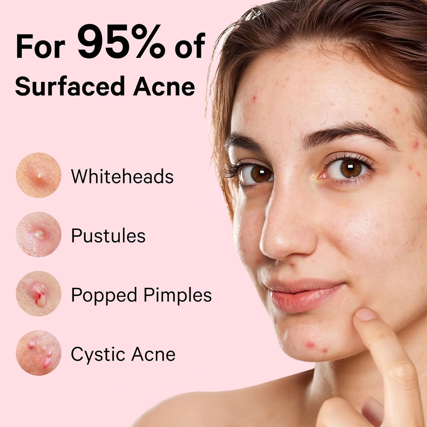 Acne™ Pimple Patch 72 Pcs