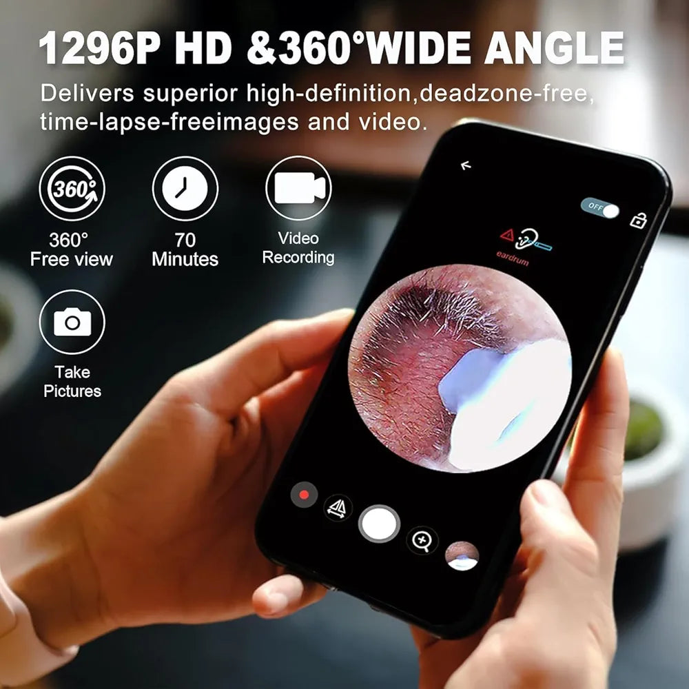 Smart Visual Earwax Cleaner