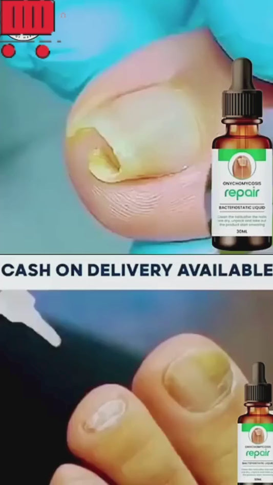 Natural Serum For Nail